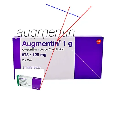 Acheter augmentin sans ordonnance